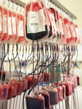 Biologie médicale: le développement de la médecine hématobiologique recommandé à Alger