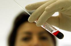 Selon les analyses de l&rsquo;institut pasteur :  Les cas suspectés du coronavirus à oran déclarés négatifs