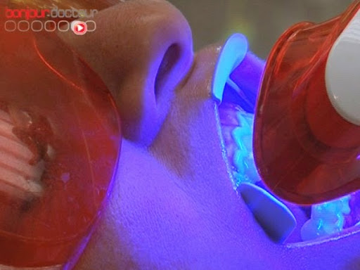 Pourquoi nos dents perdent leur blancheur