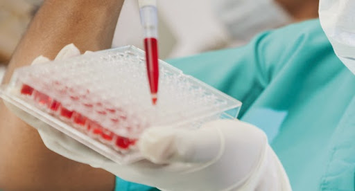 les chiffres alarmants du sida dans le monde : 6000 infections tous les 24 heures !