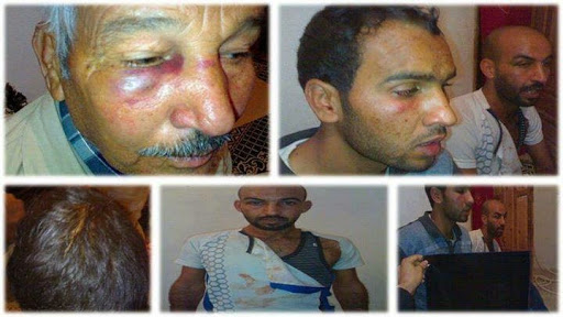 Dérapage à Laghouat: Un père et ses deux fils disent avoir été violemment agressés par des policiers