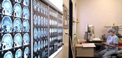 Appel à mettre en place un registre national de la sclérose en plaques