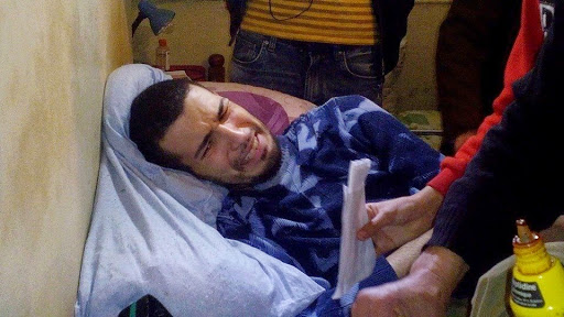 Mohamed Adlène amputé de la jambe en France