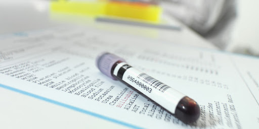 Glycémie : que révèle-t-elle ?