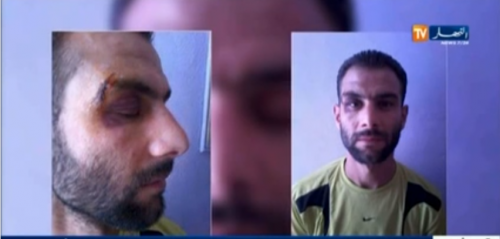 Un citoyen algérien tabassé par les douaniers et les pafistes tunisiens