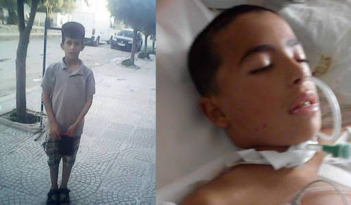 Botulisme : chronique d’un scandale sanitaire