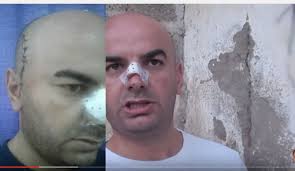 Coups, blessures et agression sauvage : Accouchement à haut risque à Bouira