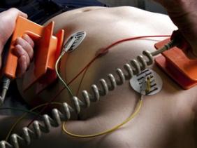 Maladies cardiovasculaires : le taux de mortalité à atteint 46.2%