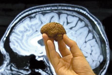 USA : un mini-cerveau humain presque complet en laboratoire