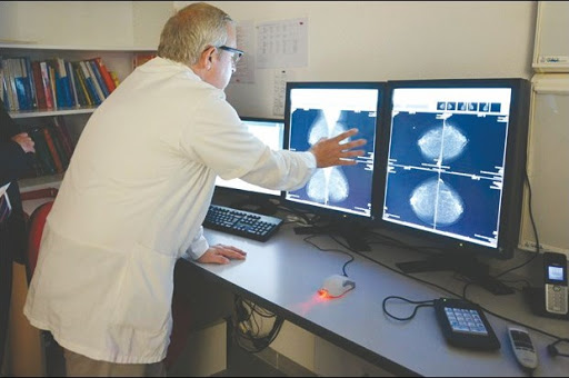 Cancer du sein, Dépistage de masse en milieu professionnel