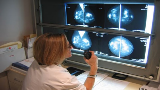 L’importance de l’imagerie médicale dans le dépistage précoce du cancer mis en exergue par un spécialiste