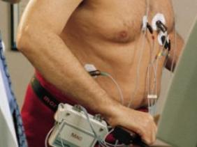 Maladies cardiovasculaires : le personnel médical, facteur aggravant ?