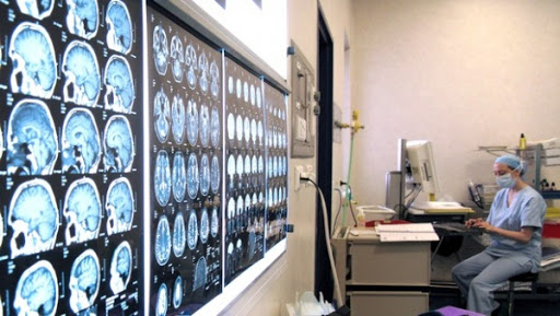 Création prochaine de la Fédération nationale des neurologues libéraux