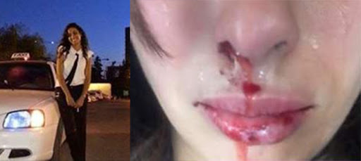 La chauffeuse de Taxi à Alger agressée par un inconnu