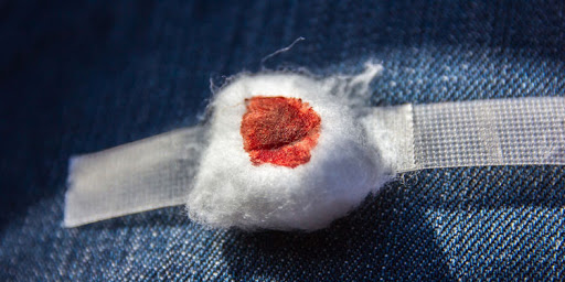 Les hémorragies stoppées par des éponges ?