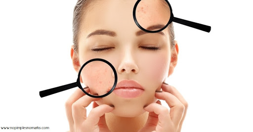 Peau grasse, mode d’emploi