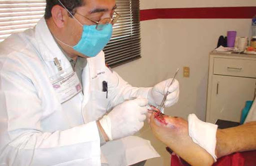 Prise en charge du pied diabétique : Appel à l’ouverture de structures spécialisées