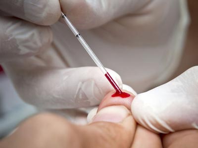 Tipasa : Lutte contre le sida L’importance de la prévention soulignée