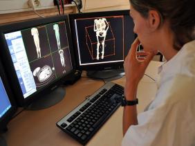 Radiologie : La formation de 72 spécialistes par an reste « insuffisante »