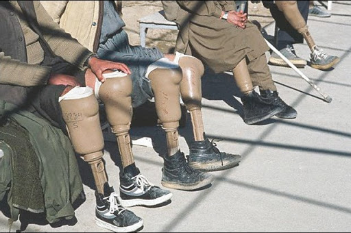 Amputé d’une jambe par l’aviation Française en 1957: un citoyen de Béni Haoua réclame une indemnisation