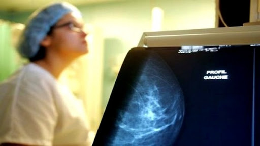 Cancer: démystifier les idées reçues et mieux vulgariser les moyens de prévention