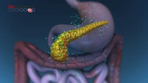 Les quatre visages du cancer du pancréas