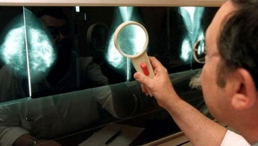 L&rsquo;évaluation préliminaire du plan anti-cancer sera soumise au président de la République en mai 2016