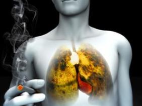 cancer de l&rsquo;appareil respiratoire en Algérie : Le tabagisme responsable de 90% des cas