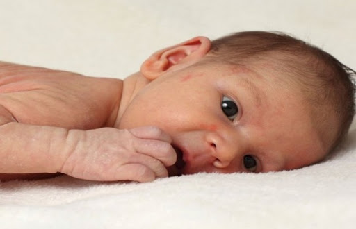 5% des Algériens souffrent de dermatite atopique