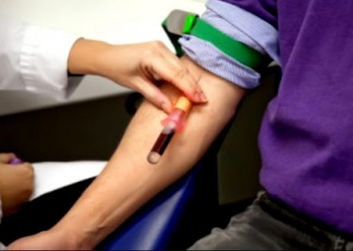 Le prélèvement des échantillons biologiques nécessite une autorisation du juge