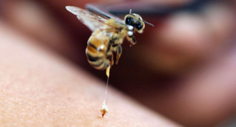 Relizane : Un jeune mortellement attaqué par un essaim d’abeilles