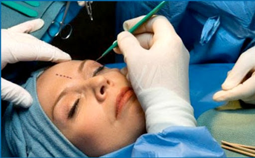 La chirurgie plastique en Algérie : pas seulement pour le « look »