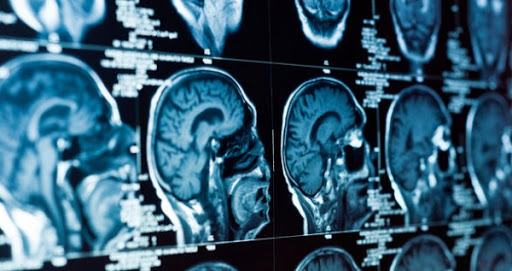 Menace de fermeture au service de neurologie de l’EHU Oran