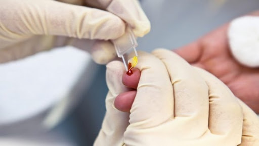 Hépatite C: lancement bientôt d’une opération de dépistage précoce