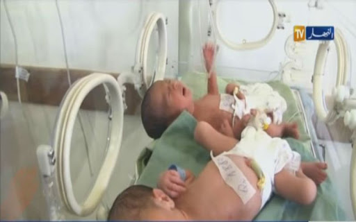 Naissance de quintuplés à l’hôpital de Kouba à Alger