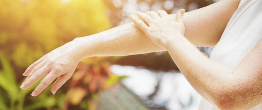 Cicatrice : un traitement pour limiter leur apparition après une brûlure