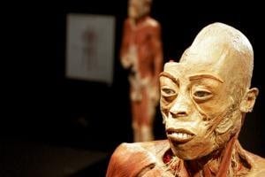 France : Our Body interdit