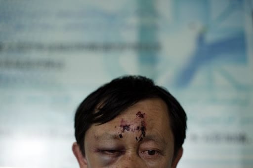 Le Xinjiang plus dangereux que le Tibet