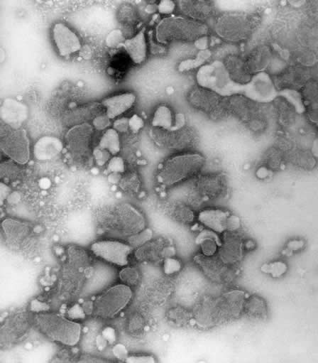 Santé : des cas humains de rage découverts dans la wilaya de Bejaia