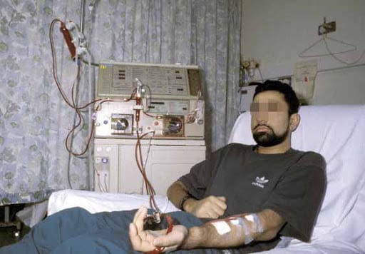 Tizi-Ouzou : Les insuffisants rénaux lance un SOS