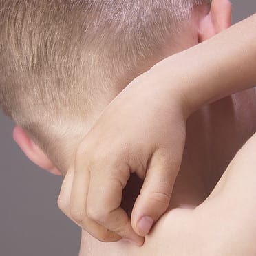 Tout savoir sur l&rsquo;urticaire