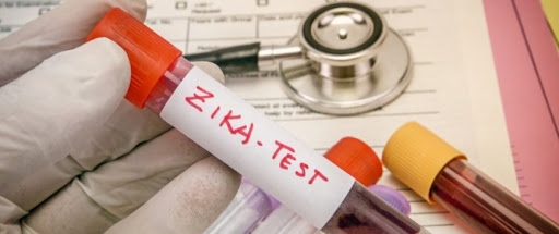 Virus Zika : des dangers pour le cerveau adulte ?