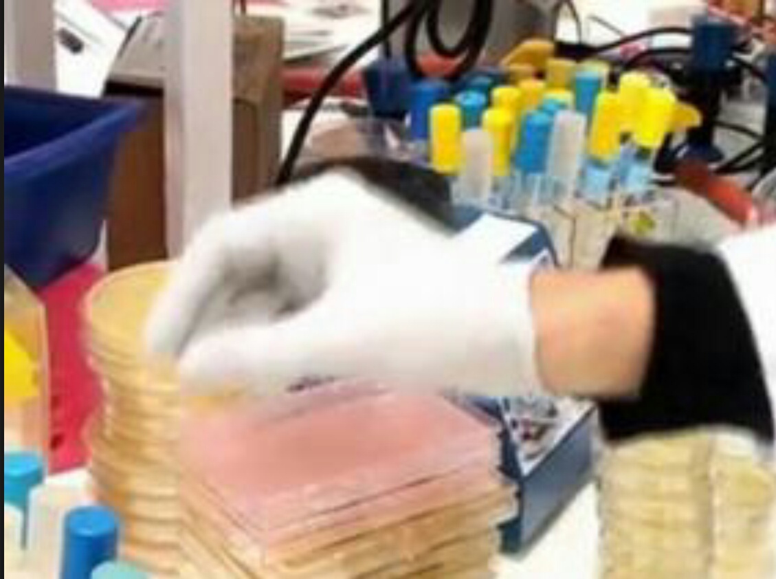 Maladies du sommeil : une Unité d’étude créée à l’hôpital d’Oran