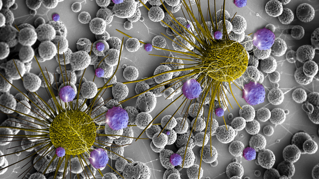 Microsoft prétend pouvoir bientôt traiter les cancers comme des « virus informatiques »