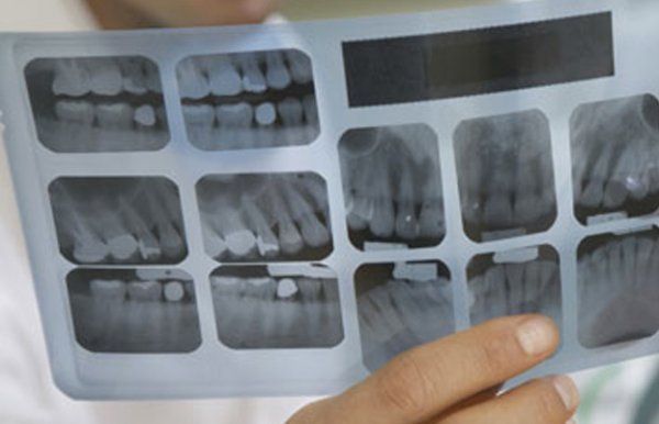EPSP de chirurgie dentaire Mohamed Rédha-Aslaoui de Bir Mourad Raïs: les patients invités à acheter des clichés pour les radios