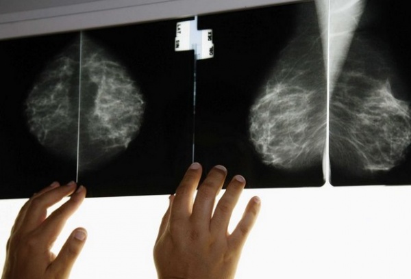 Cancer du sein: Le dépistage fait son chemin