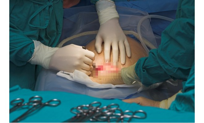 Serment d’Hippocrate ou business d’hypocrites ?