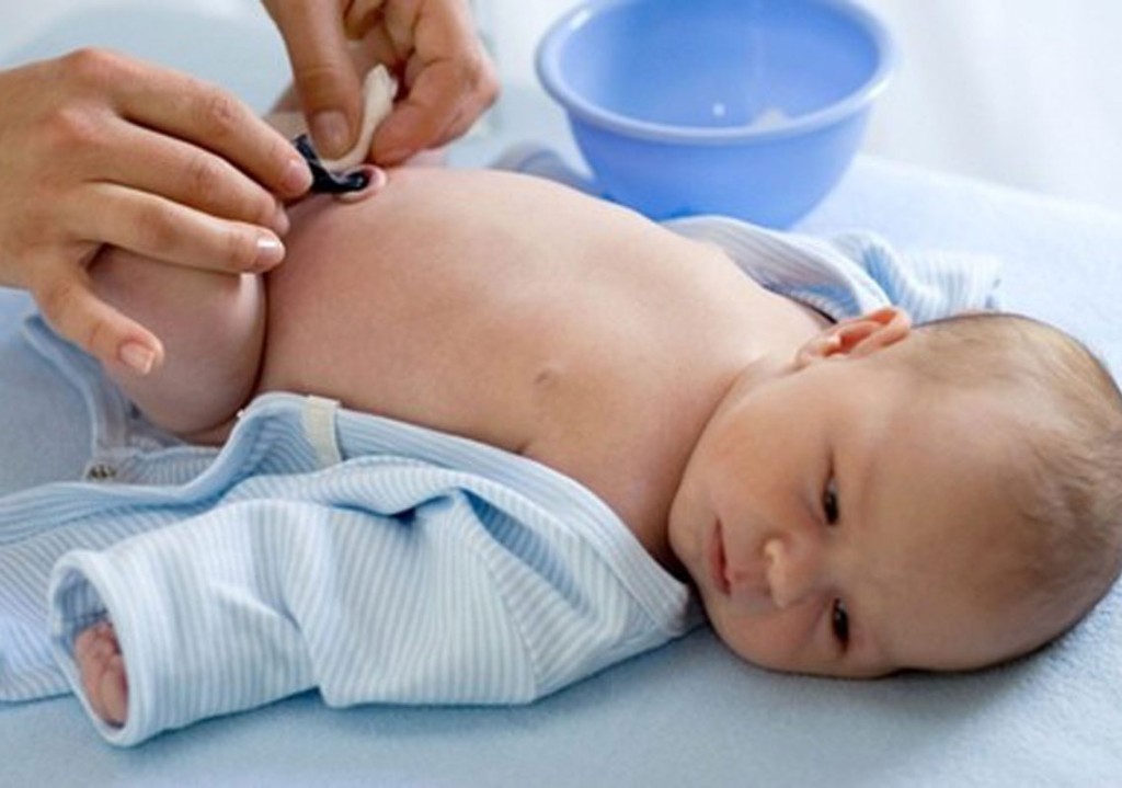 Soigner l’infection du cordon ombilical de son bébé