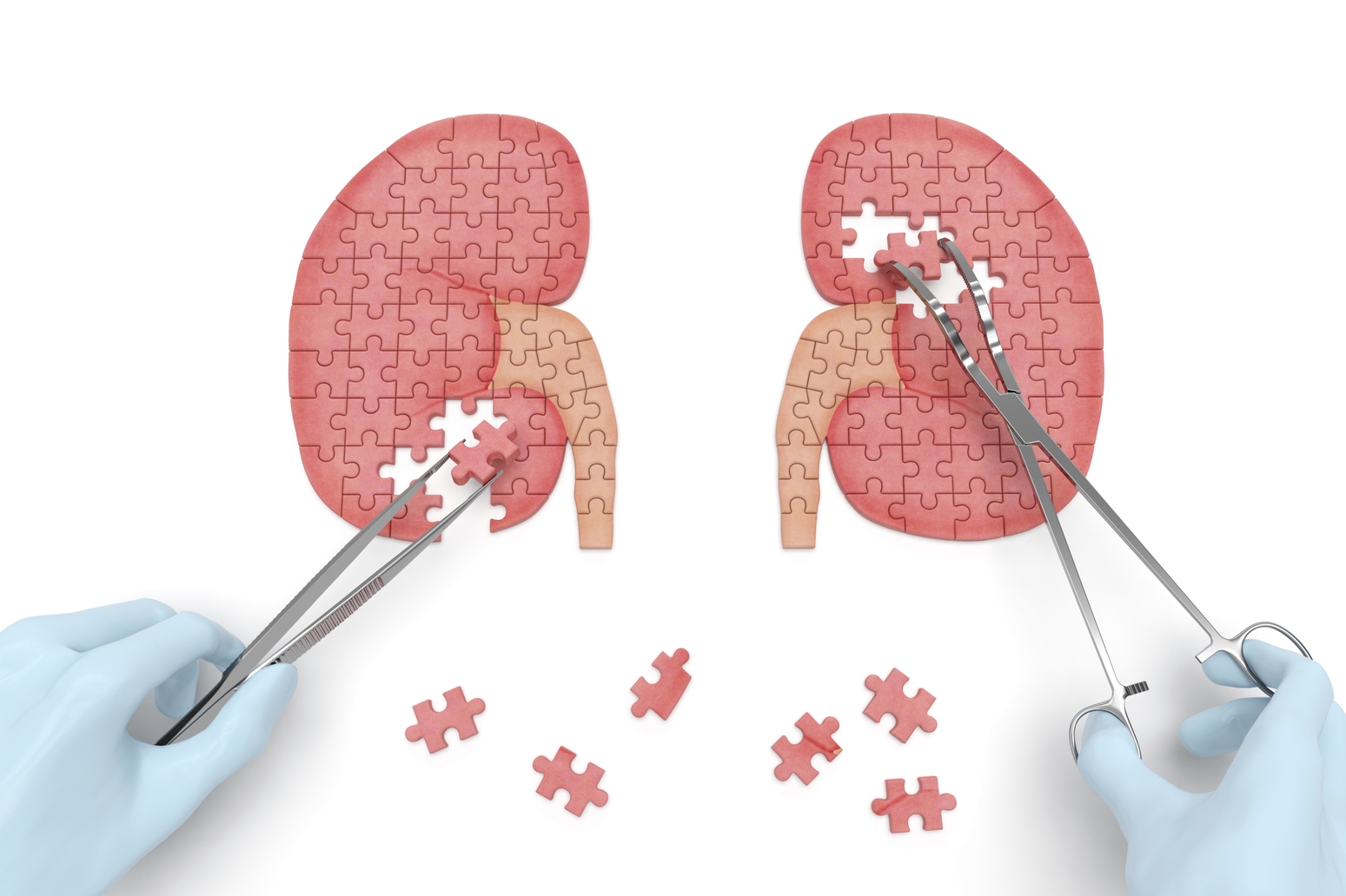 Lancement de la greffe rénale: Le manque de volonté politique pointé du doigt