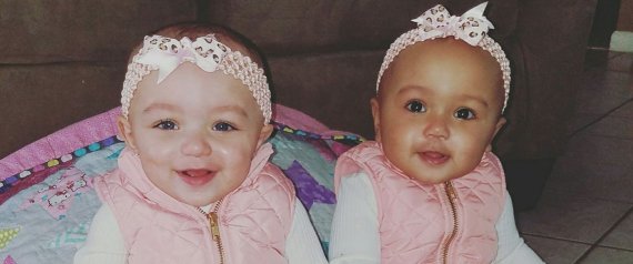 De rares jumelles qui n’ont pas la même couleur de peau font le tour du Web